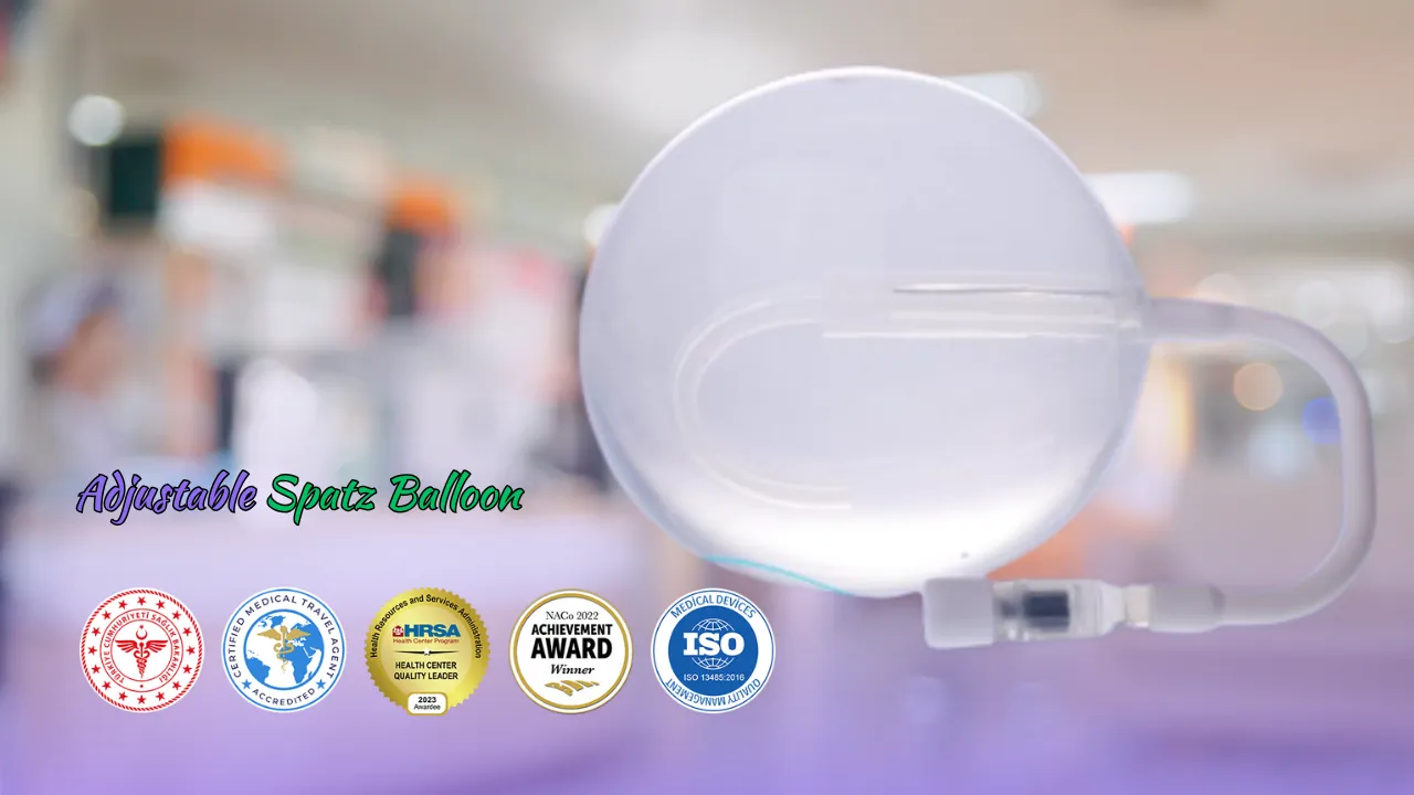 Adjustable Spatz Balloon