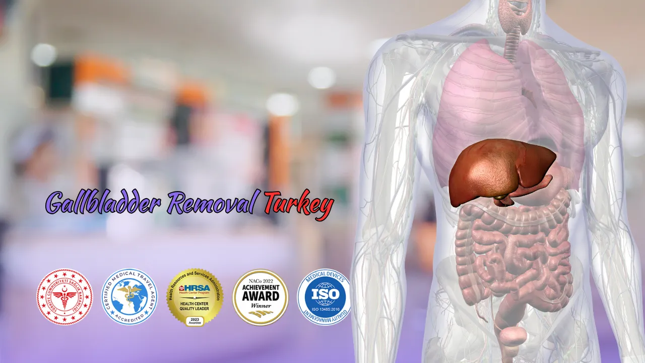 Gallbladder Removal Turkey