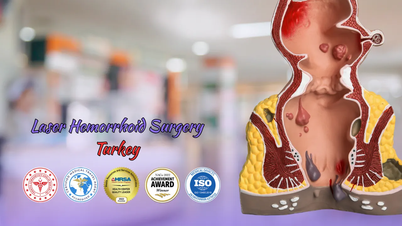 Laser Hemorrhoid Surgery Cost Turkey