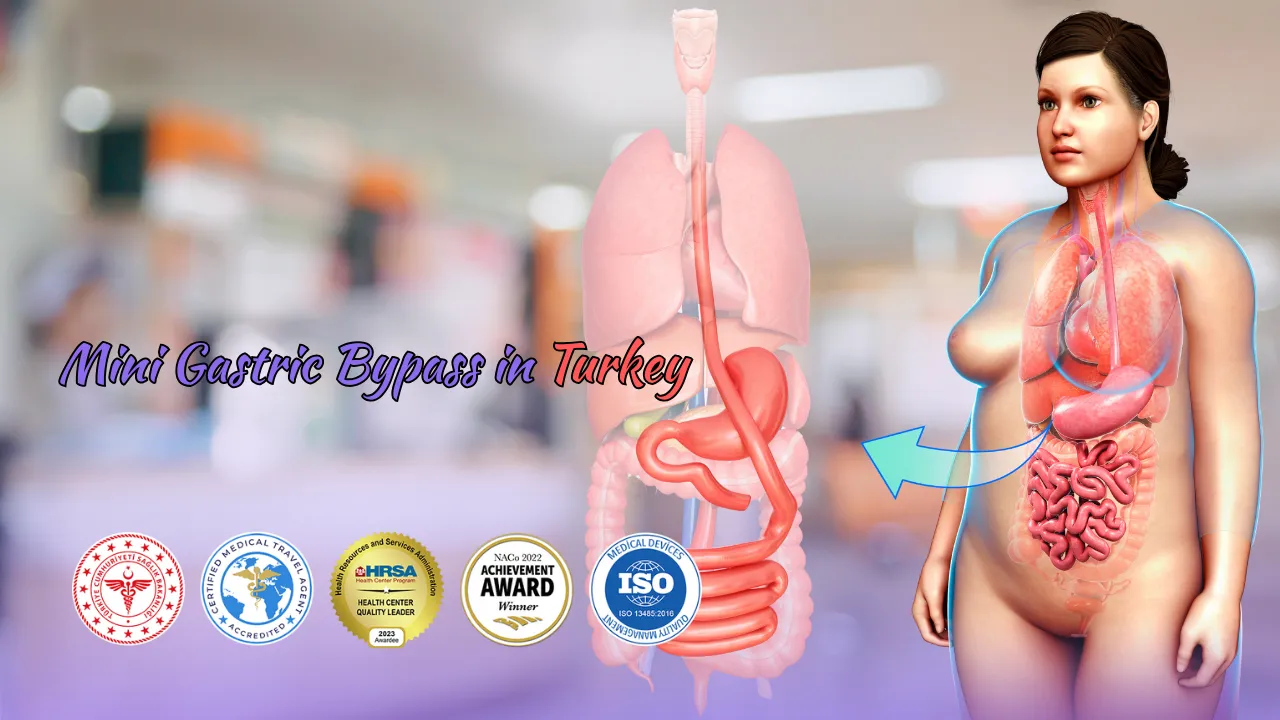 Mini Gastric Bypass Cost in Turkey