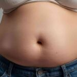 Hormones & Weight Loss After Gastric Sleeve